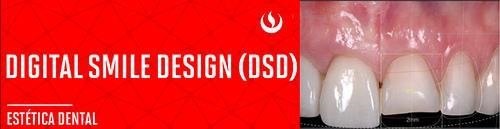 Escuela de Odontología UPC auspicia curso Internacional Digital Smile Design (DSD) y conferencia Estética Internacional